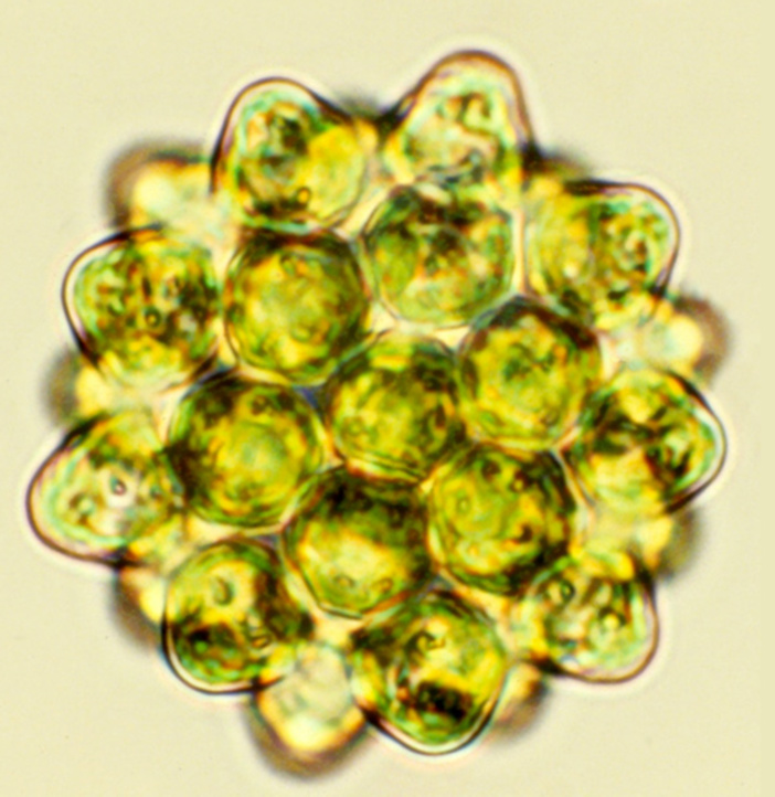 Coelastrum sp. Coelastrum sp.